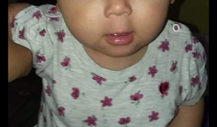 Pela saúde da minha filha de 1 ano. Ela tem EPILEPSIA 😢