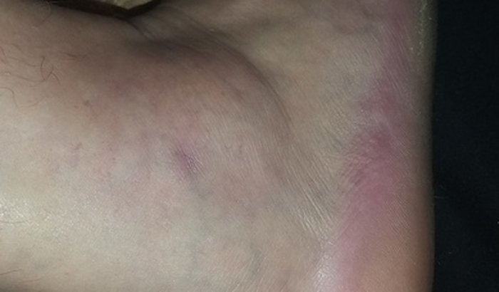 Ajuda para marcos....