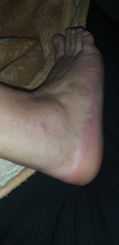 Toda ajuda sera bem vinda... ajuda Marcos fazer ressonância magnética com contraste ...