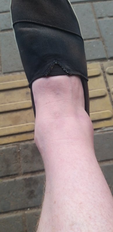 Ajuda para marcos fazer ressonância magnética com contraste.