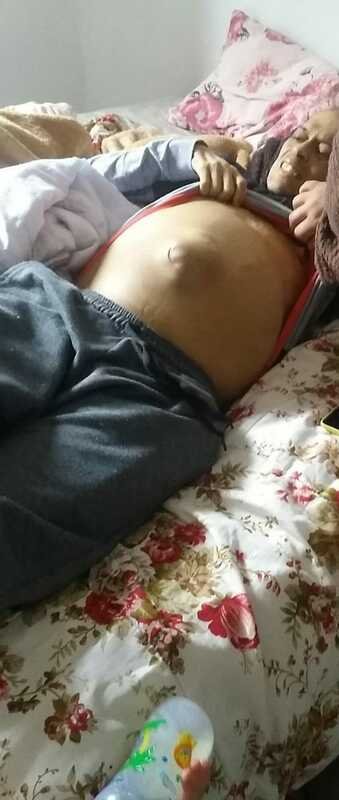 Ajudá o rui com câncer 