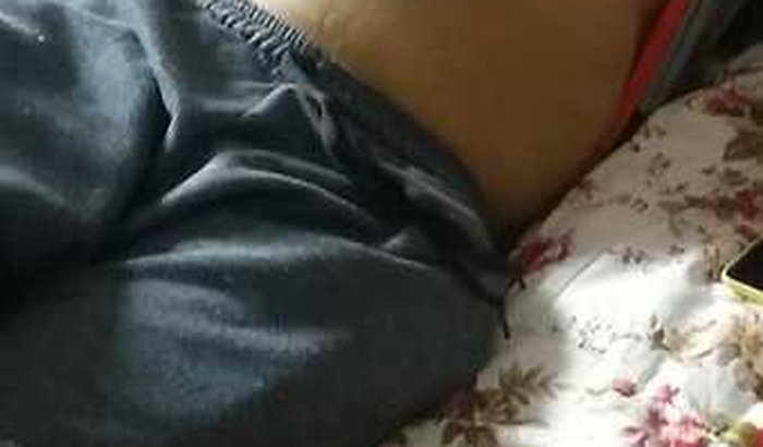 Ajudá o rui com câncer 