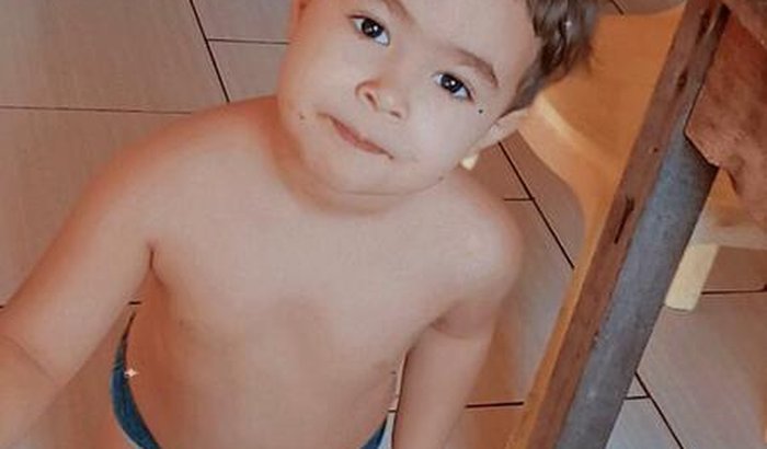 Cirurgia de hipospadia do Arthur