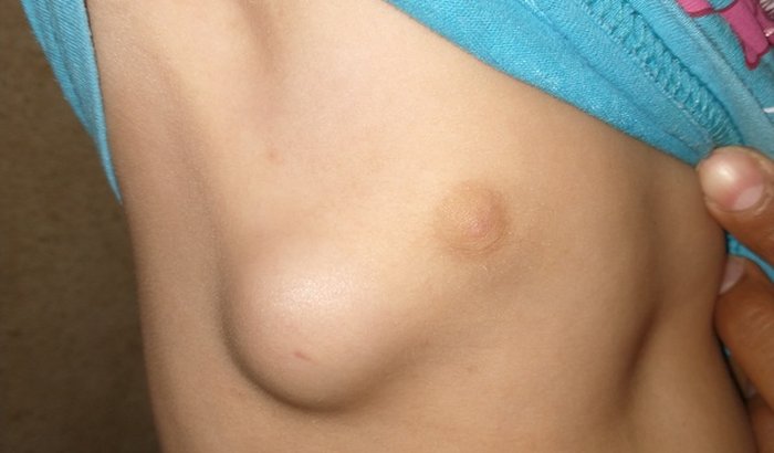 Preciso de uma ajuda para fazer uma cirurgia na minha filha que deu um tumor no tórax.