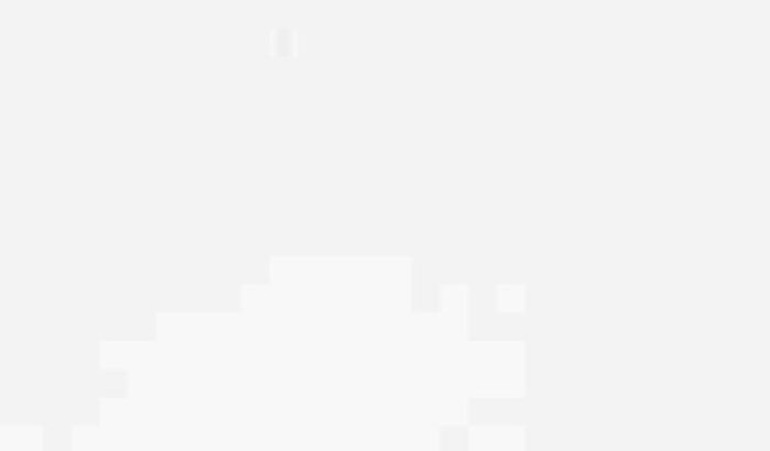 Ajuda para cirurgia de ceratocone da Mayara