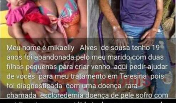 Cirurgia urgente para dona Conceição