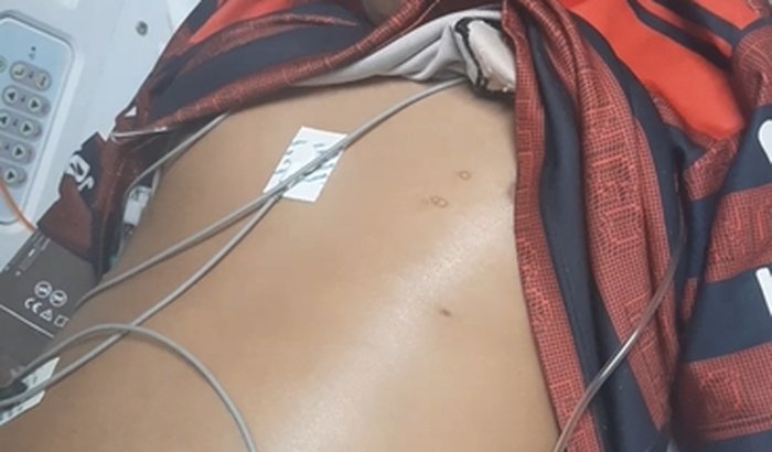 Ajuda na compra do remédio do Thayrick  Vieira ( voriconazol 200mg)