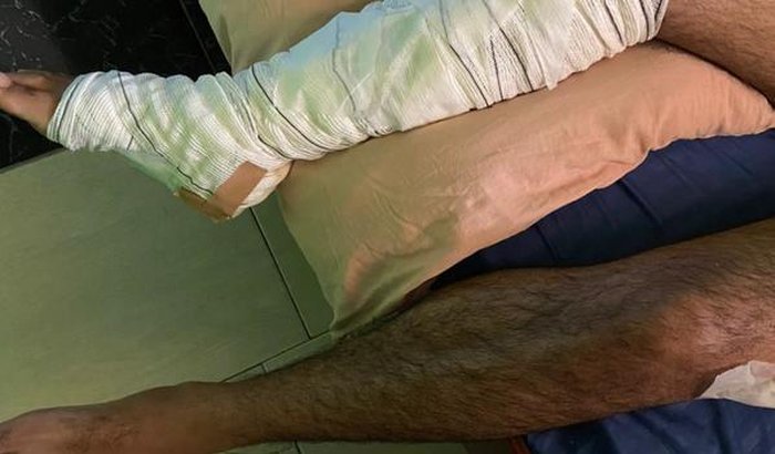 Ajuda para Erick Luan sofreu um acidente de moto grave