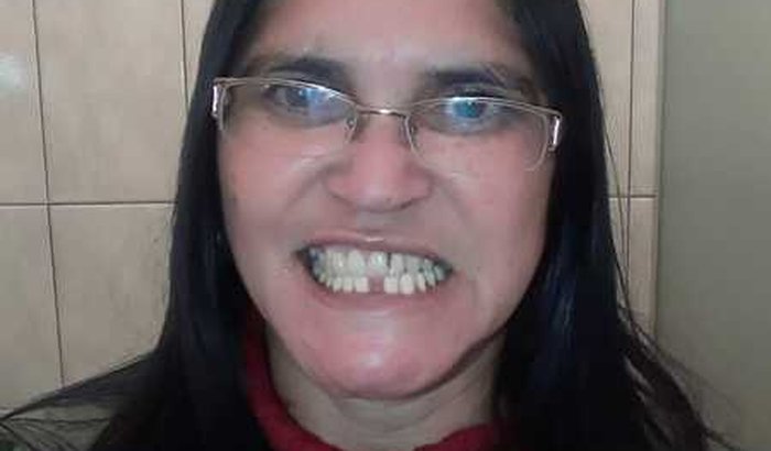 Ajude a Maria a conseguir cirurgia e implante dentário