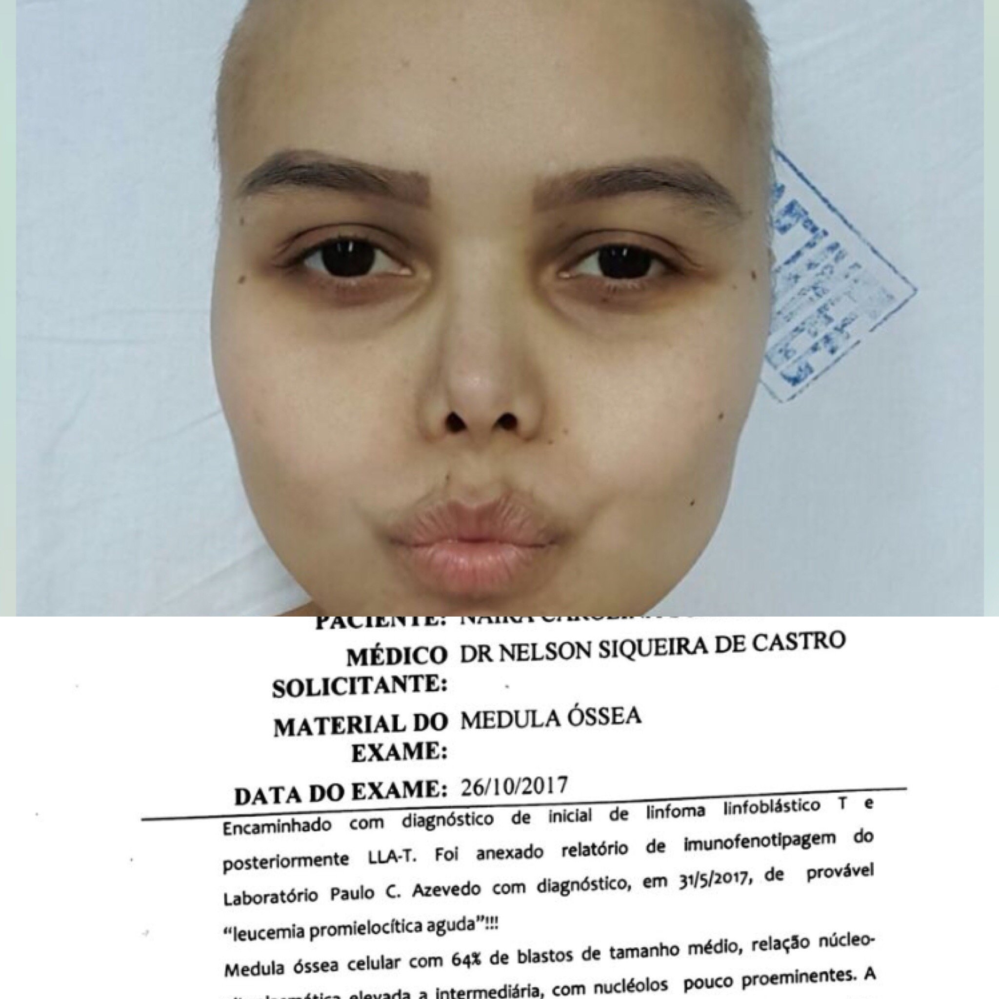 imagem da vaquinha Ajude Carolina Soares - Vítima de Leucemia Linfoblástica Aguda