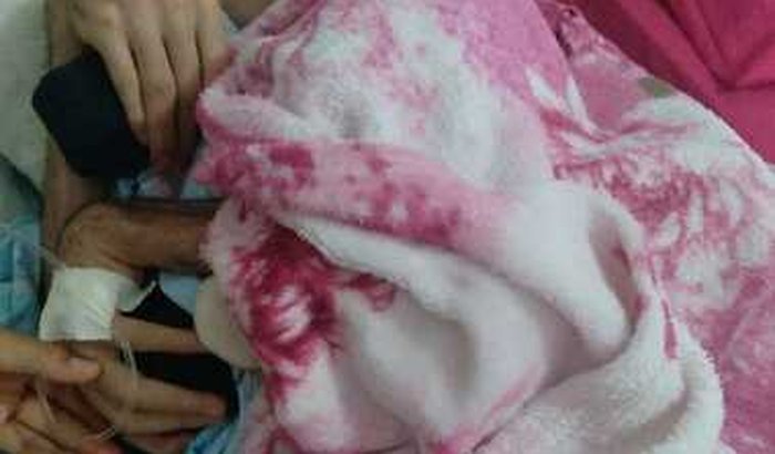 Jackson teve uma paralisia cerebral a 7 anos e só tem piorado