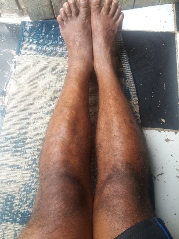 imagem da vaquinha Realizão de exame e tramento