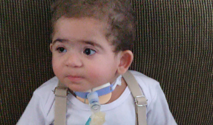 Custos e benefício do Miguel