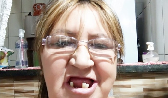 Preciso de uma protese dentária me ajdem por favor a levantar monha alta estima