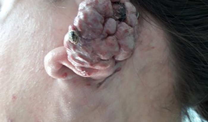 LUTA PELA VIDA DE PAULA REIS