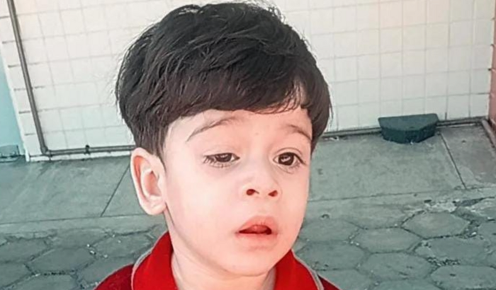 Ajudar a realização de Uma cirurgia de Pitose Congênita palpebral em meu Sobrinho João Miguel