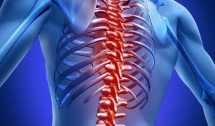 Tratamento de Espondiloartrose na Coluna Torácica e lombar.