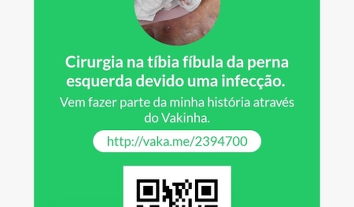 Cirurgia na tíbia fíbula da perna esquerda devido uma infecção. 