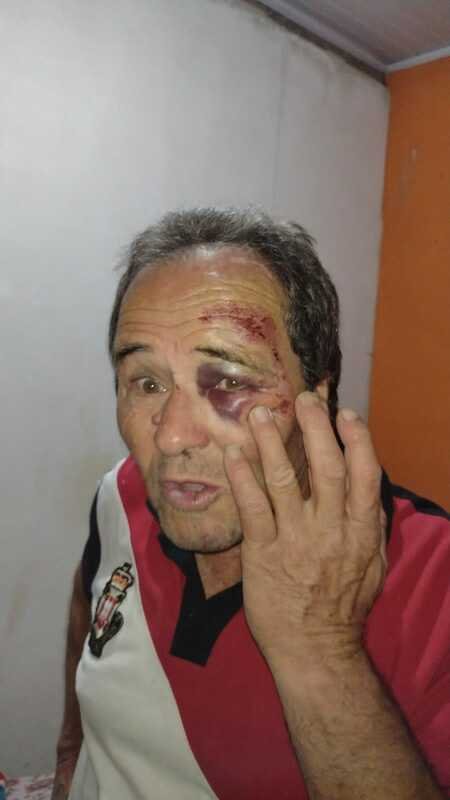 imagem da vaquinha Ajudar a comprar um novo óculos para meu tio 