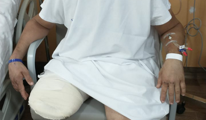 Prótese da perna direita