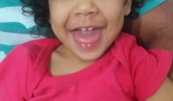 Todos por Malu - Microcefalia com amor