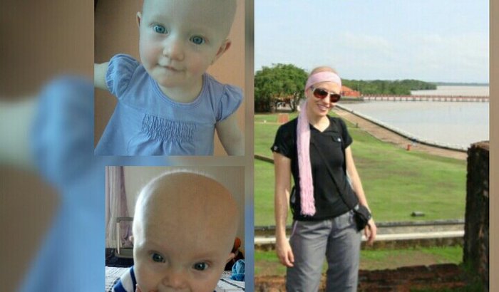 Busca da cura capilar de Maria Inez e os filhos