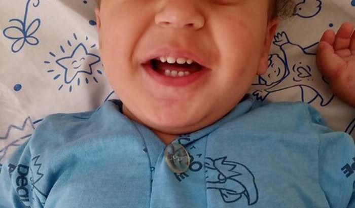 Ajuda para pós cirúrgico do Gael