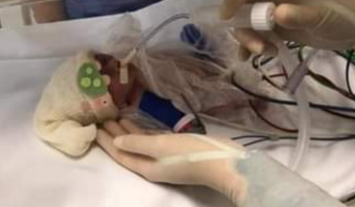 Ajuda a dois bebês gêmeos prematuros