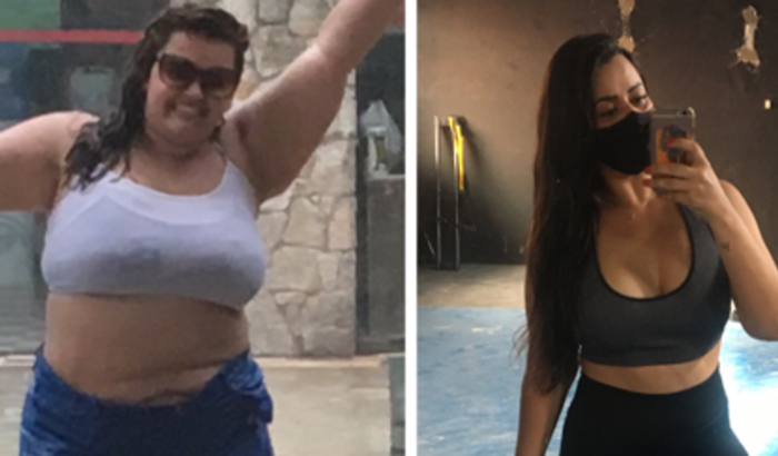 Cirurgia Plástica (retirada de excesso de pele)