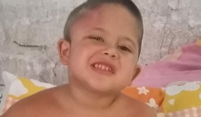 Auxílio para o tratamento do Bernardo