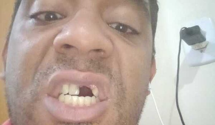 Me ajude a recuperar meu sorriso