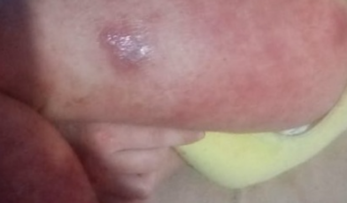 Ajude no Tratamento da Maria Helena