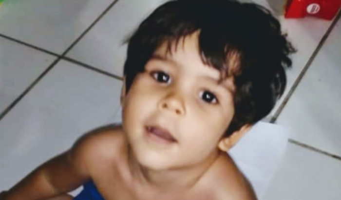 Ajuda Para Cirurgia Hemisferectomia Do Meu Filho