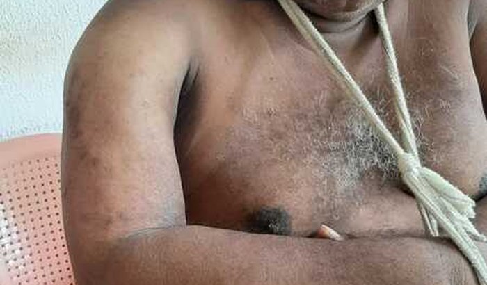 Raimundo nonato balbino