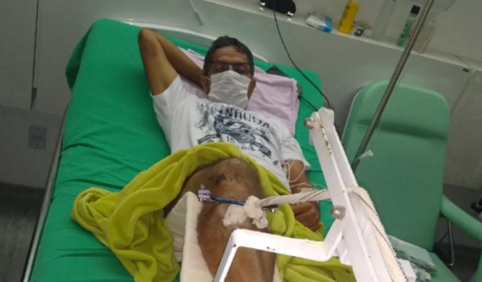 Ajuda para o custear a cirurgia do Seu Junior Artroplastia do Total do