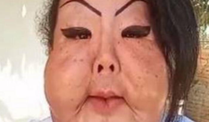 cirurgia facial sonho de uma vida melhor