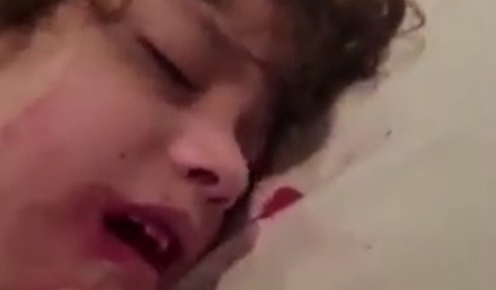 MIGUEL CONTRA O LINFAGIOMA - SALVE UMA VIDA