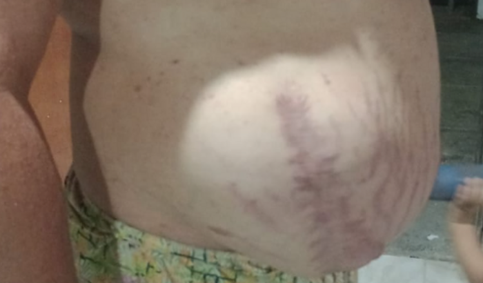 Vakinha para o ANDRÉ