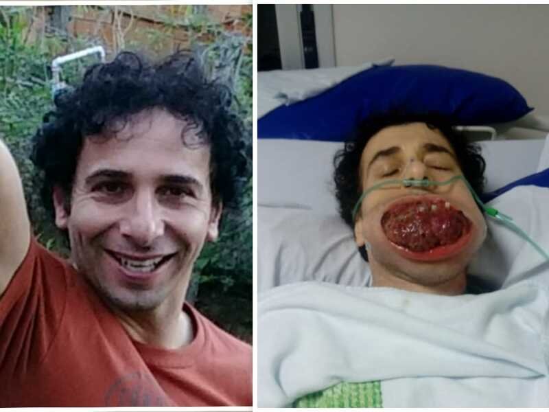 imagem da vaquinha Todos pelo Leandro