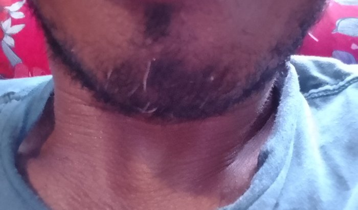 Ajuda para um implante dentário para José Carlos,( Agência 3066),(Conta poupanca 1007256.5)Banco Bradesco.