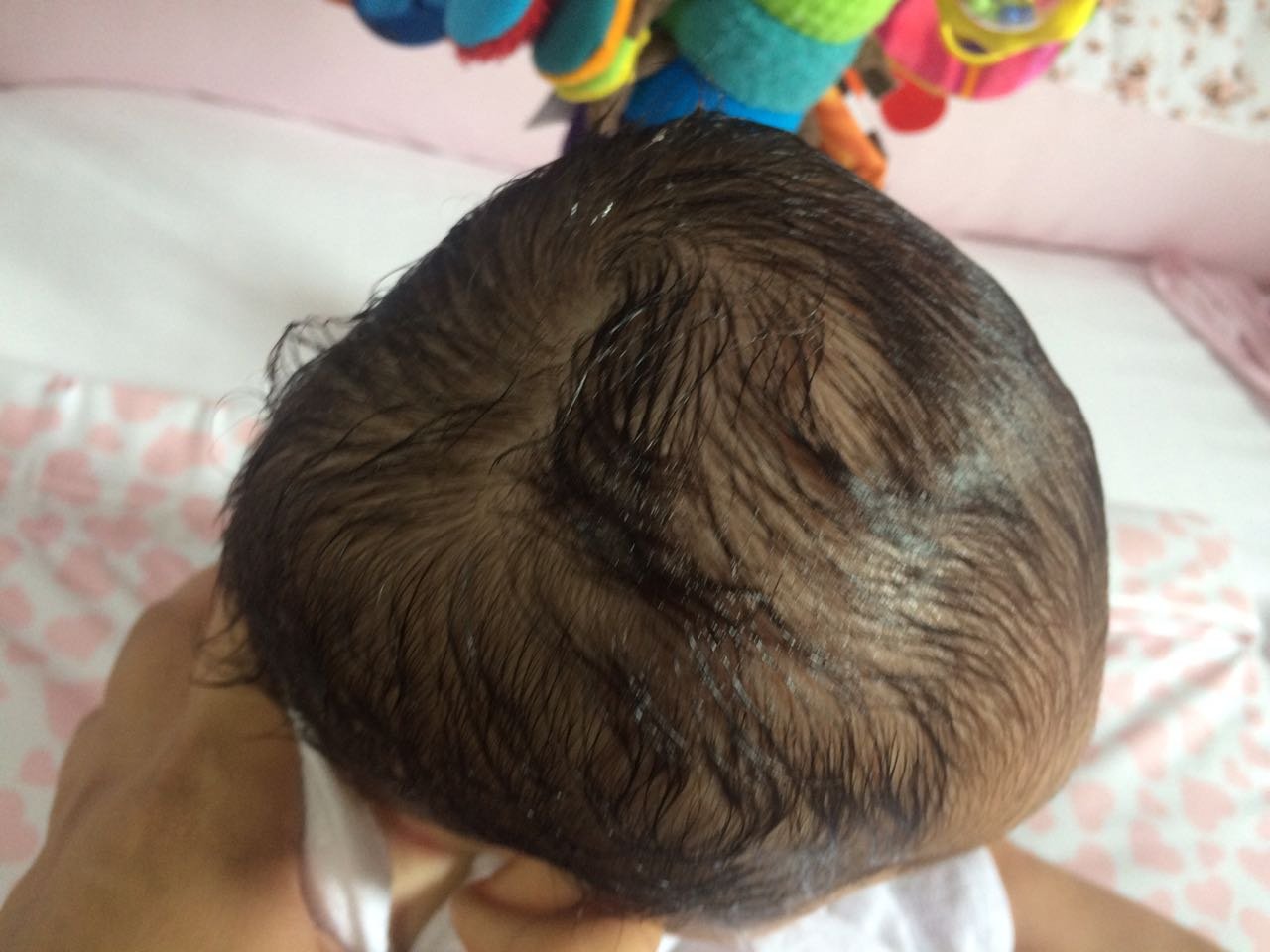 imagem da vaquinha Tratamento de Plageocefalia com Ortese para Ayla