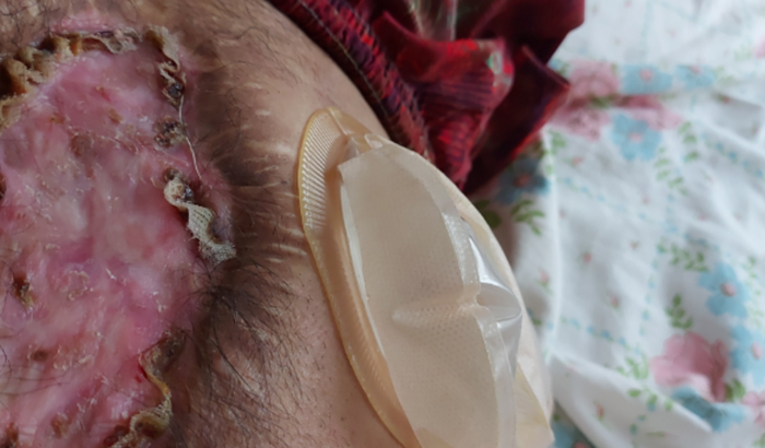Ajuda pra fazer minha cirurgia 