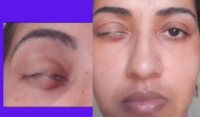 meus olhos, minha visao👀 vakinha atualizada em 22/08/2024