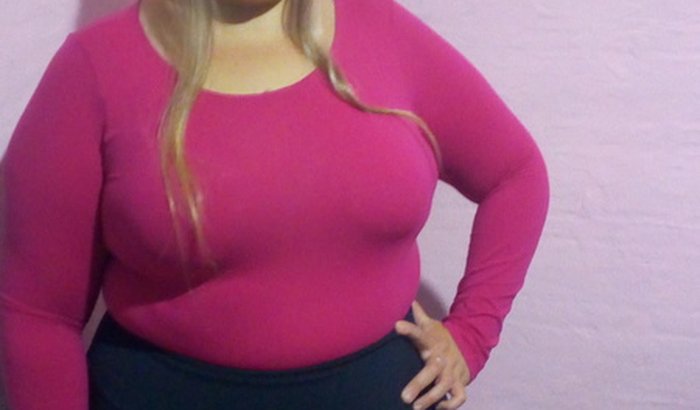 Cirurgia bariátrica