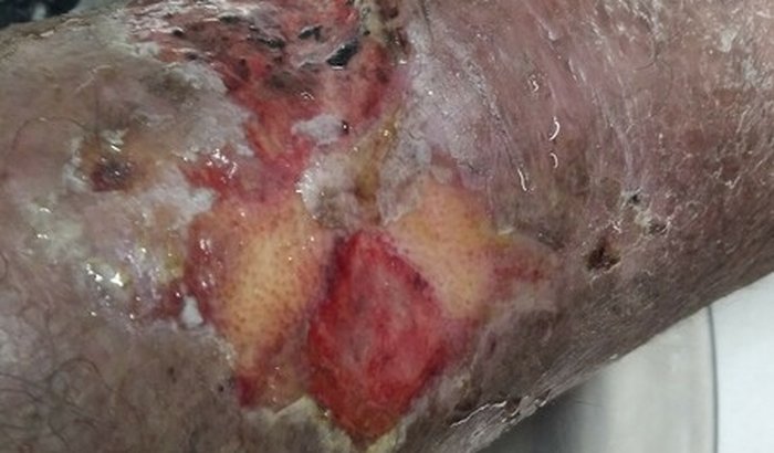 CIRURGIA VASCULAR URGENTE