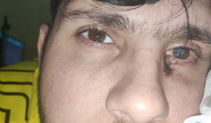 Ajuda para o Bernardo voltar a enxergar