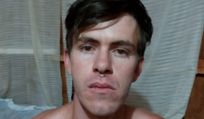 Ajudar o Diego com o custeio de cirugia na face