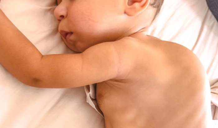 Unidos pelo Noah - Duas síndromes, uma super rara progressiva!