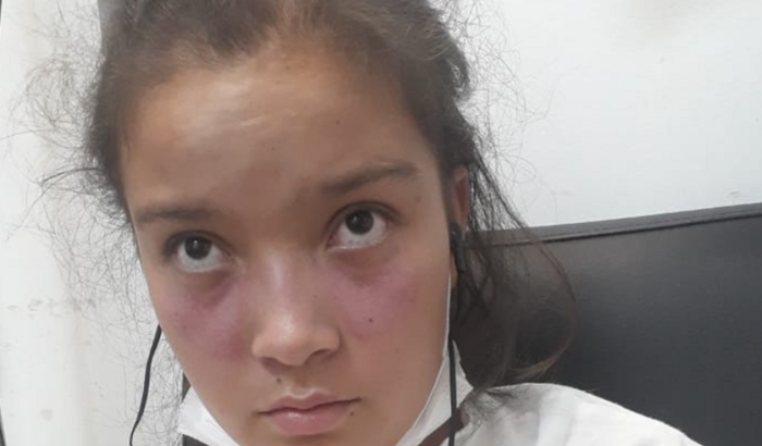 Ajuda para o tratamento do lúpus eritematoso e hipertireoidismo.