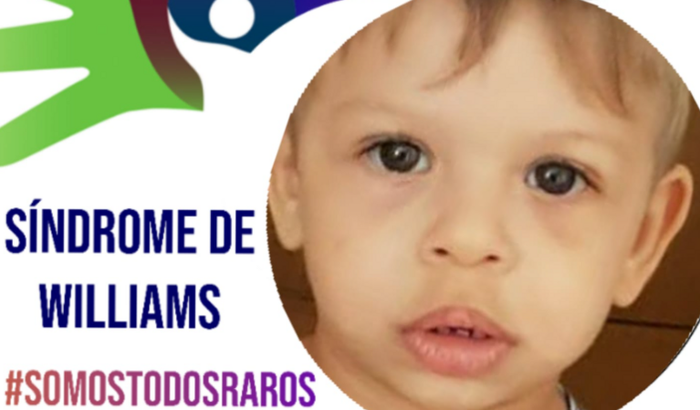 Ajuda para o exame do Arthur (Síndrome de Williams)